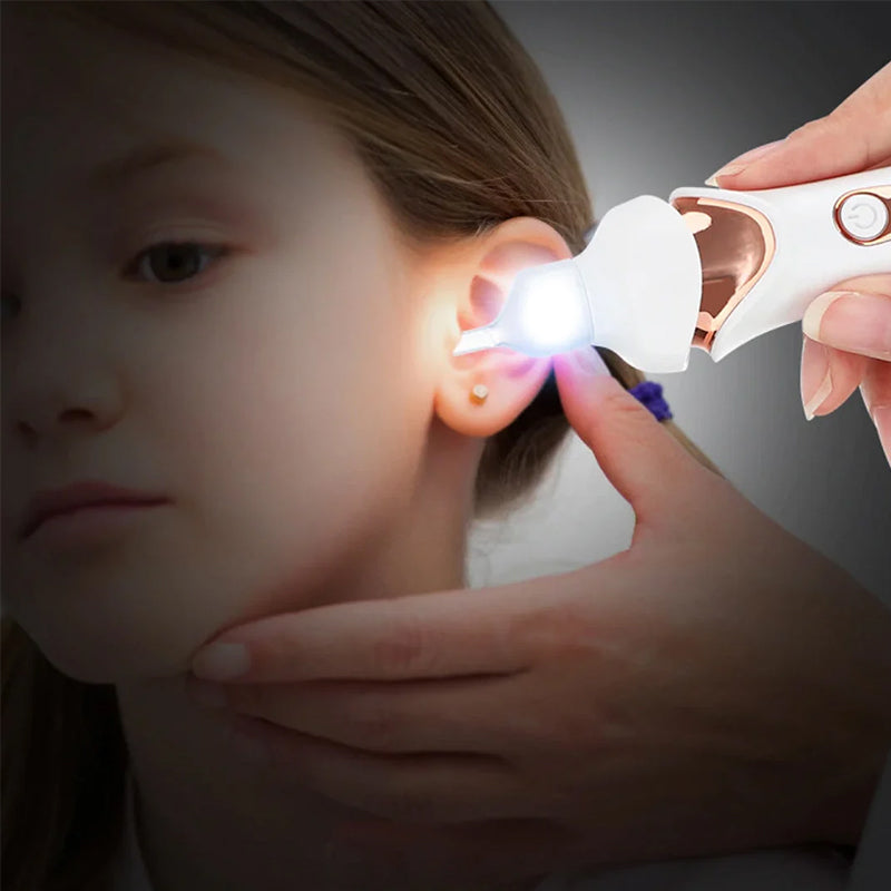5 in 1 Electric Earwax Cleaner | Stornfield