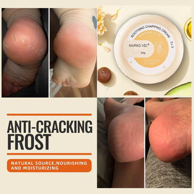 Winter Anti-Rip Frost | Stornfield