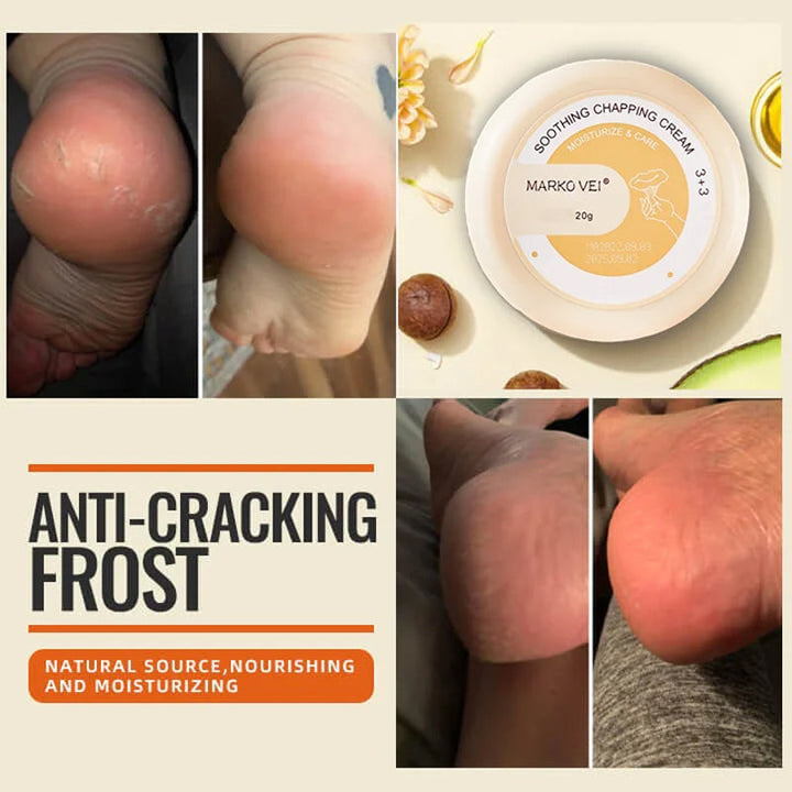 Winter Anti-Rip Frost | Stornfield