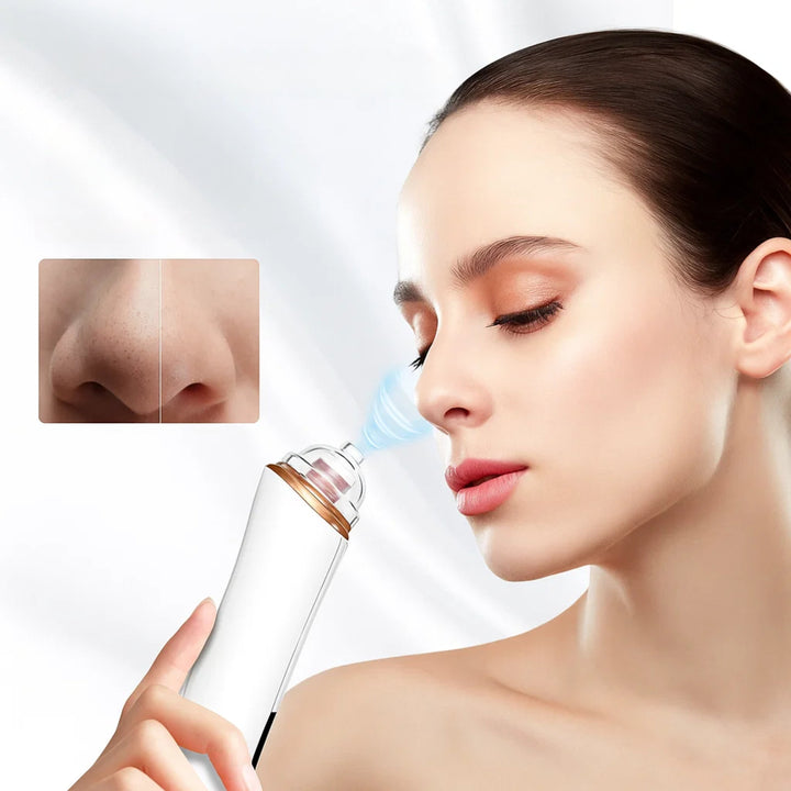 GlowEase | Microdermabrasion Kit - Blackhead Remover - USB Rechargeable - At-Home Skincare Solution Stornfield
