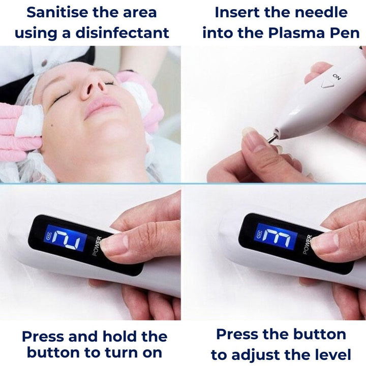 DermaGlow | Mole Removal Pen – Non-Invasive Plasma – Cordless & Rechargeable – At-Home Skin Tag & Freckle Treatment Stornfield