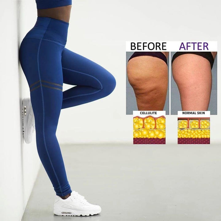 Stornfield | Women's Anti-cellulite Compression Leggings