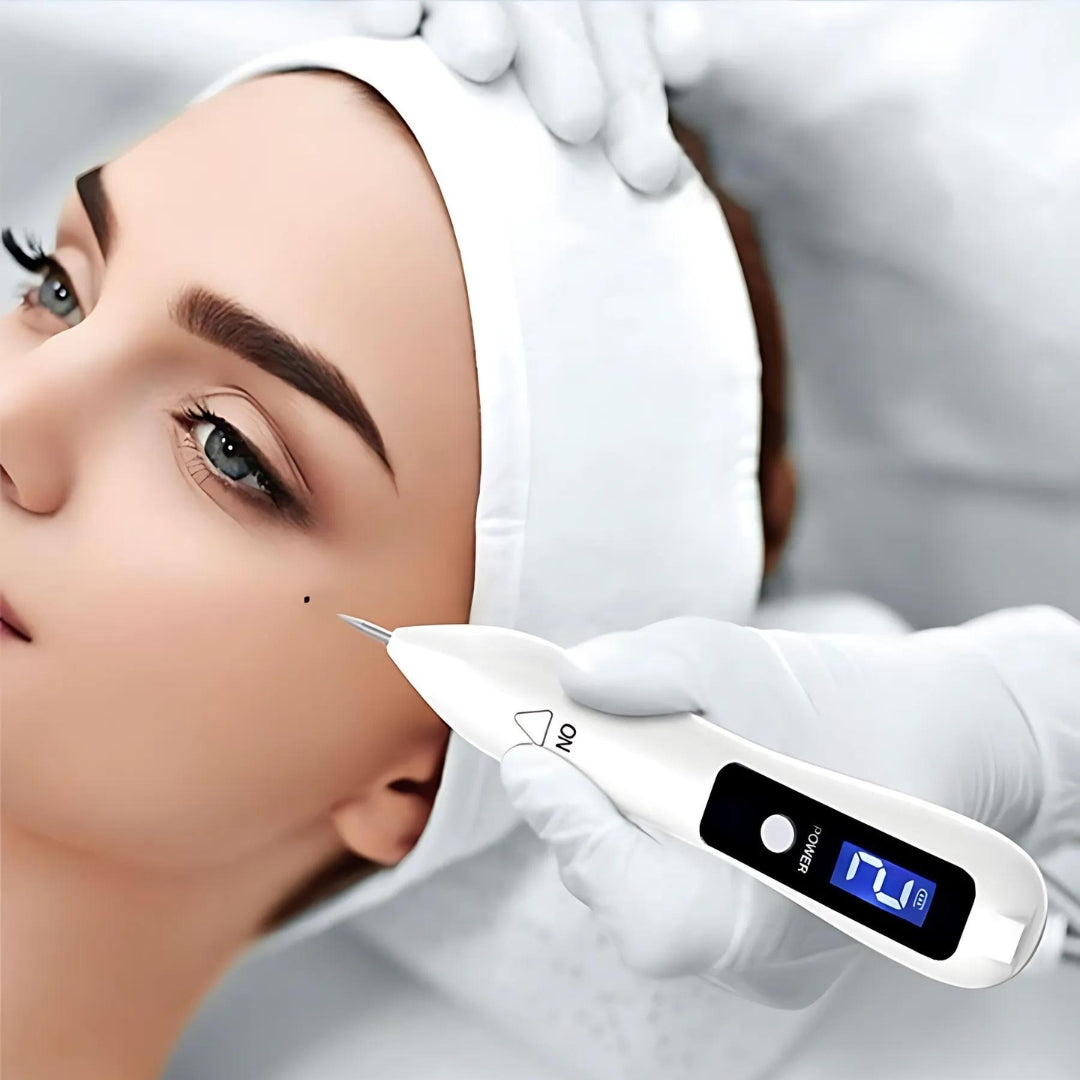 DermaGlow | Mole Removal Pen – Non-Invasive Plasma – Cordless & Rechargeable – At-Home Skin Tag & Freckle Treatment Stornfield
