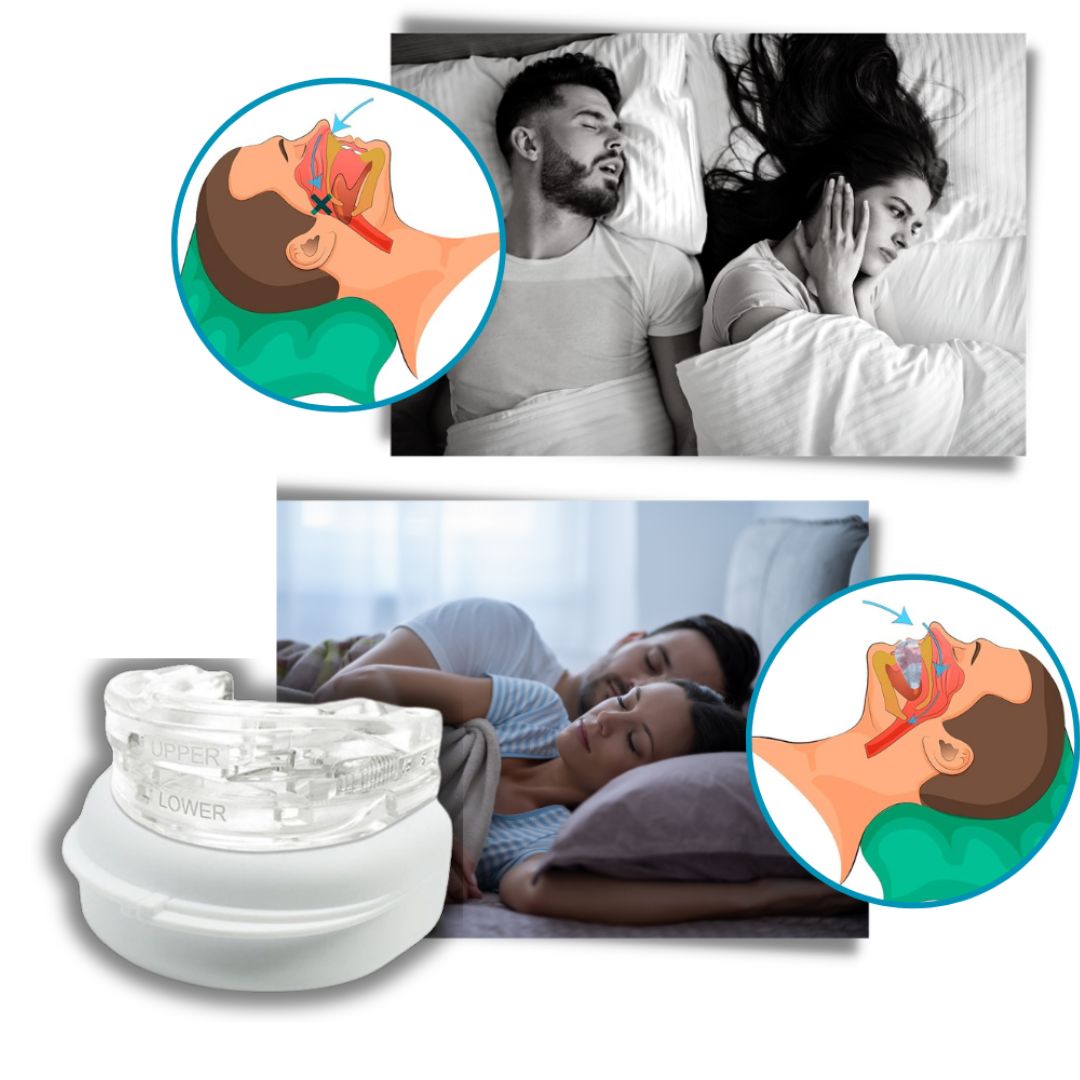 SilentEase | Anti-Snoring Mouthpiece – Medical Grade Silicone – Improves Airflow – Ideal for Snoring Sufferers Seeking Better Sleep Stornfield