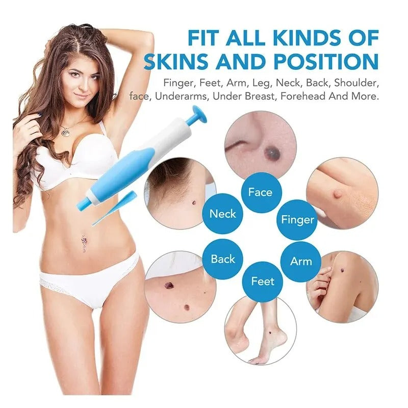 Stornfield | Ingrown Hair Removal Kit