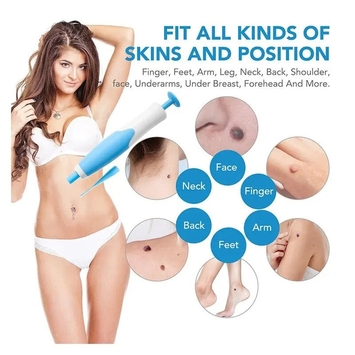 Stornfield | Ingrown Hair Removal Kit