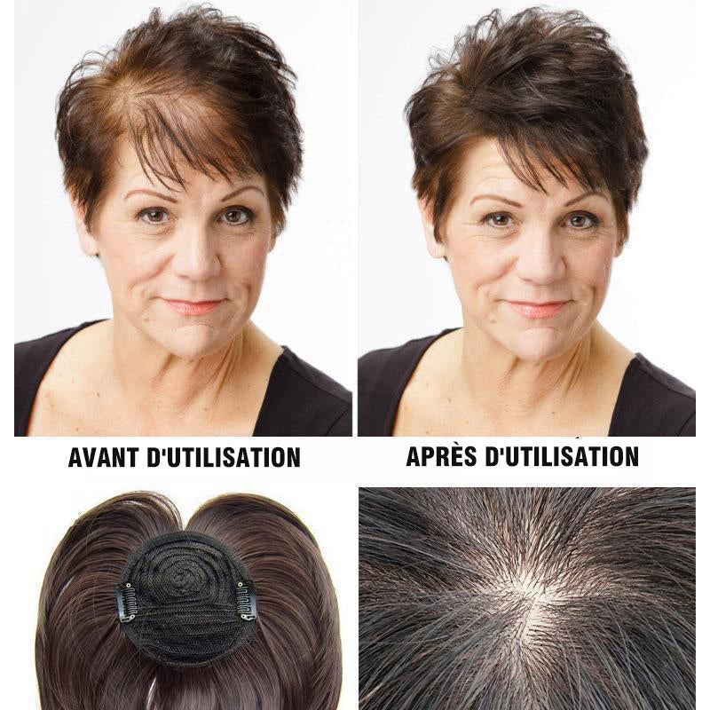 Wig Replacement Patch | Stornfield