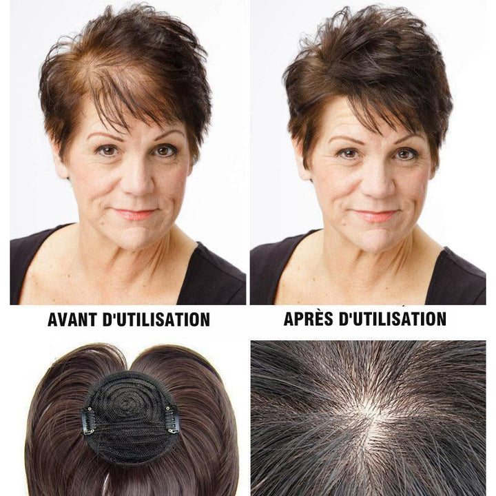 Wig Replacement Patch | Stornfield