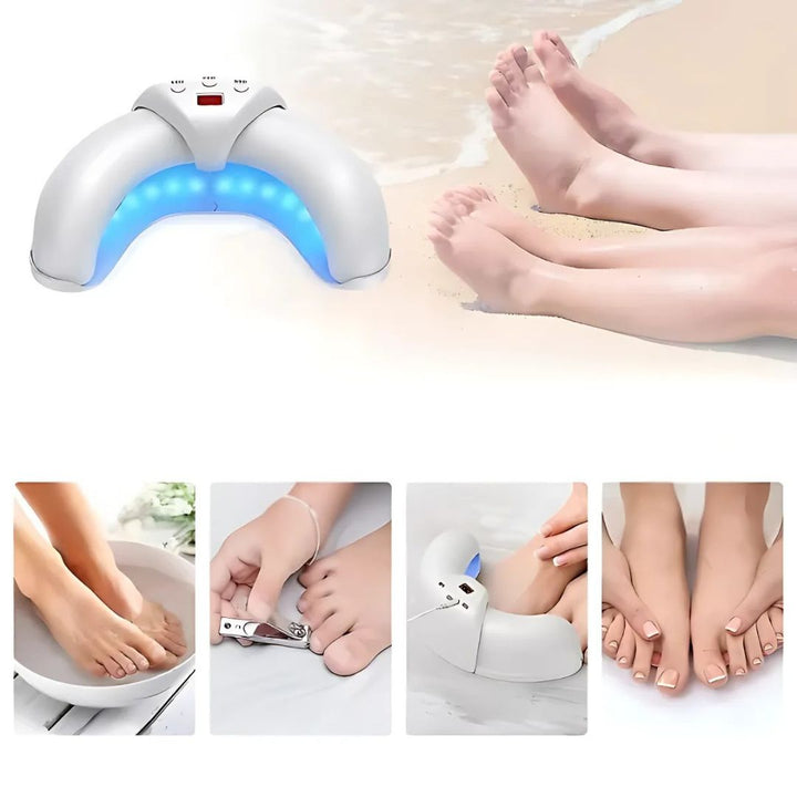 FungiFree | Laser Device for Nail Fungus - Dual Wavelength Penetration - Compact Home Use - Stornfield Fungal Nail Recovery