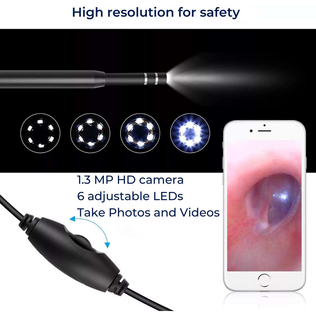 EarVision Professional Ear Endoscope – HD Inspection – Live Monitoring – Capture Images & Video – Removes Wax & Foreign Objects Stornfield