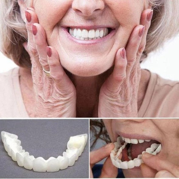 Stornfield | On Smile Veneers (Upper and Lower Jaw included)