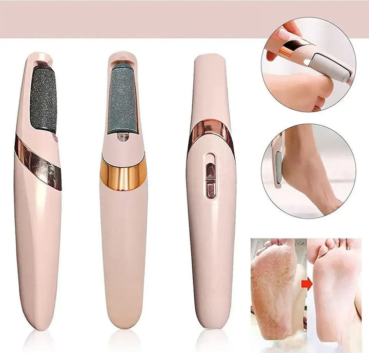 Advanced electric callus remover for smooth feet | Stornfield