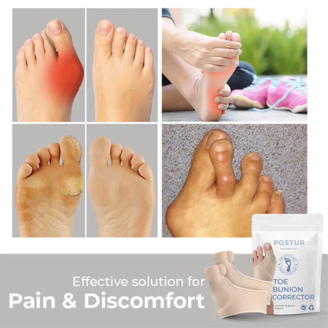 Stornfield | Bunion Corrector 2.0 – corrective support – pain relief – comfortable – wall clock