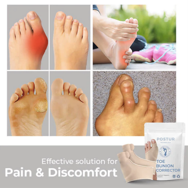 Stornfield | Bunion Corrector 2.0 – corrective support – pain relief – comfortable – wall clock