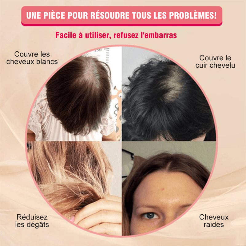 Wig Replacement Patch | Stornfield