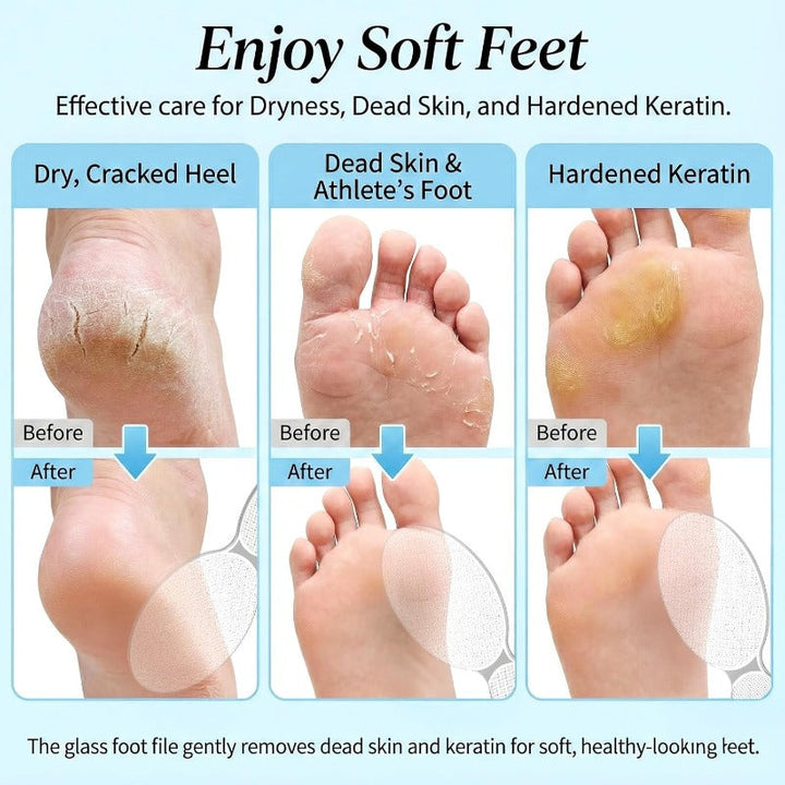 Seamless Glass Foot File Stornfield
