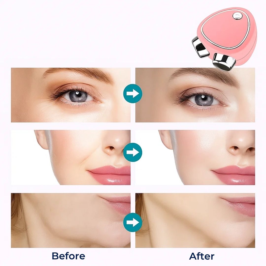 RejuvTone | EMS Facial Toner - Non-Surgical Face Lift - Lightweight USB Rechargeable Device - Stornfield Anti-Aging Skin Care