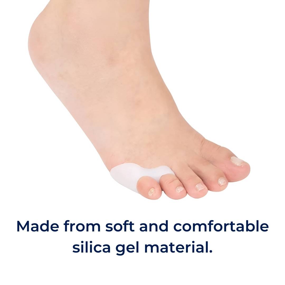 ToeGuard Orthopedic Toe Spacers | Bunionette Corrector - Little Toe Straightener - for Bunions - Hammertoe and Toe Alignment Stornfield