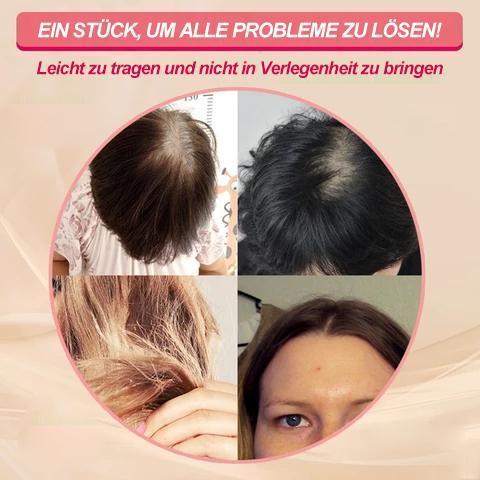Special head hairpiece