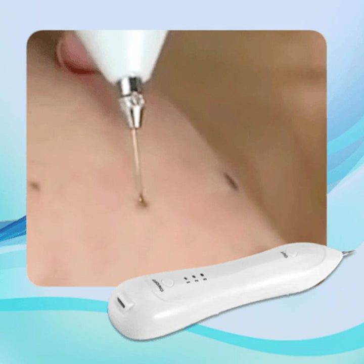 Stornfield | Facial Hair Removal Pen