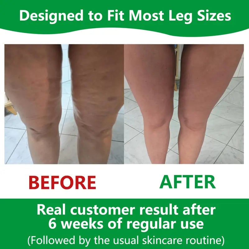 Stornfield | Sakerplus Cellulite Massage Roller