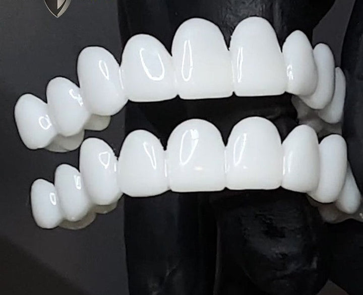 Cosmetic Tooth Toppers SmileShape – Reusable, Flexible and Naturally White | Stornfield