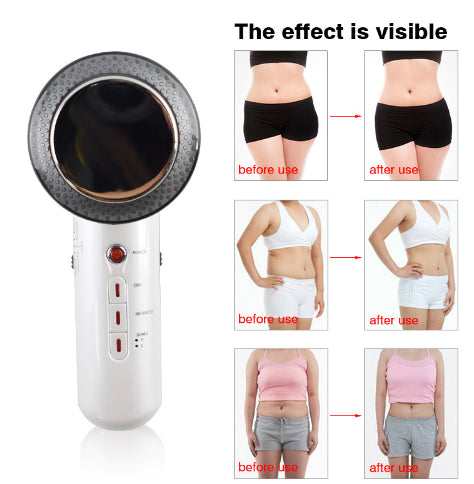 Stornfield | Ultrasonic Massage Device