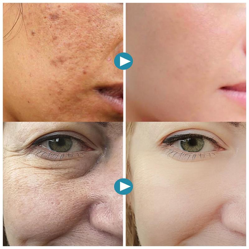 SilkPores Smooth and Radiant Skin | Stornfield