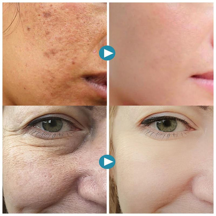 SilkPores Smooth and Radiant Skin | Stornfield