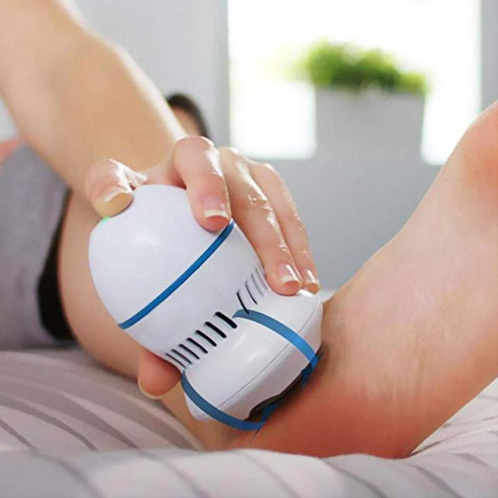 Automatic Callus Remover | Stornfield