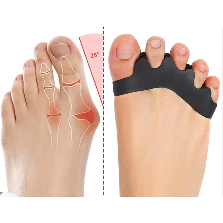 FlexAlign Toe Spacer | Toe Realignment and Pain Relief – Ideal for Bunions - Overlapping Toes - and Foot Comfort Stornfield