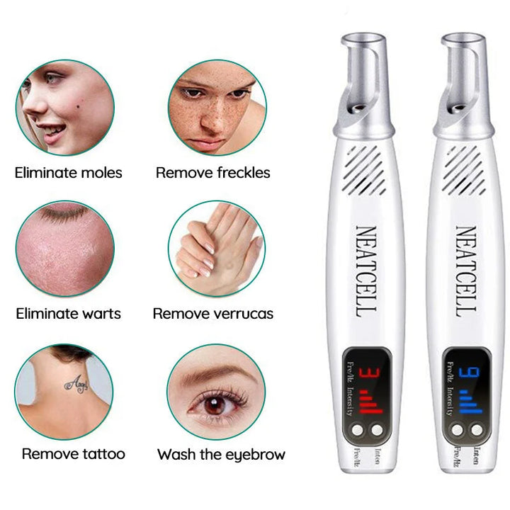 Stornfield | Laser Removal Pen | Laser Tattoo Removal Red & Blue