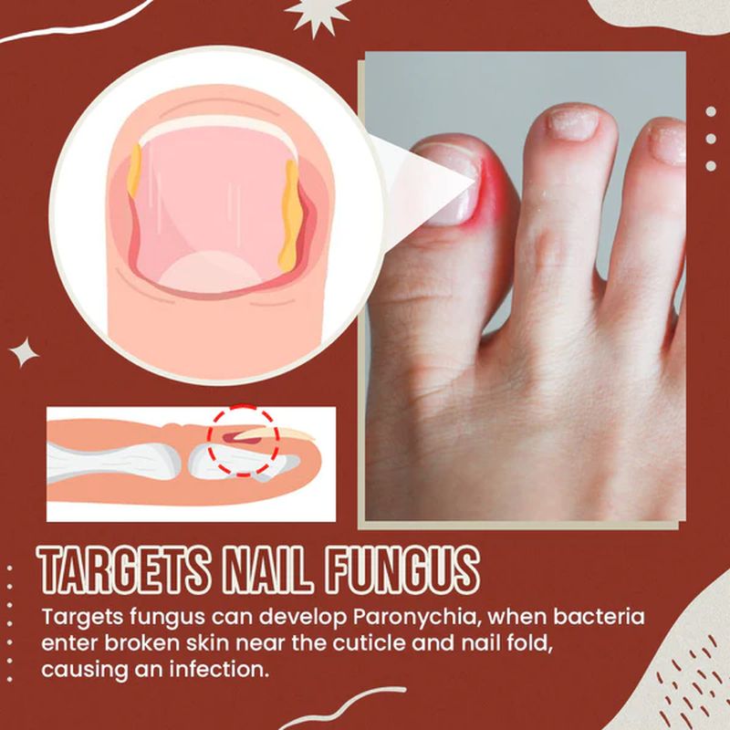 Stornfield | Nail Anti-Fungus Socks