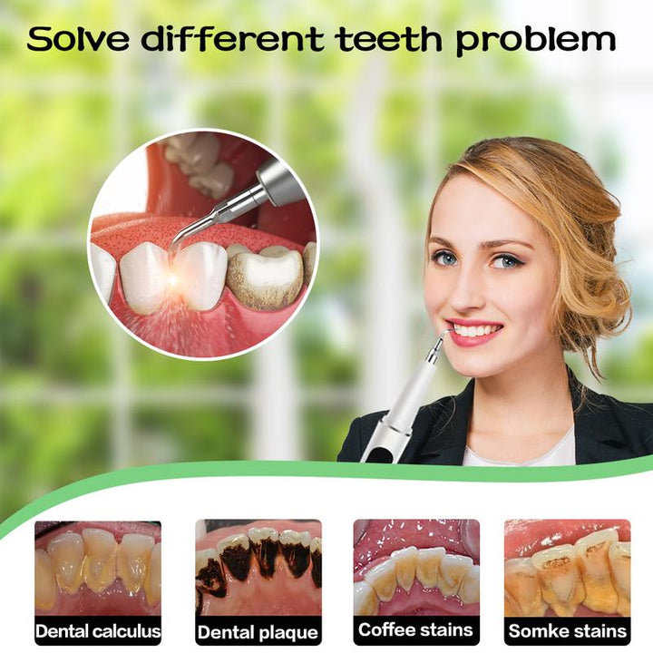 Ultrasonic Electric Tooth Cleaner Stornfield