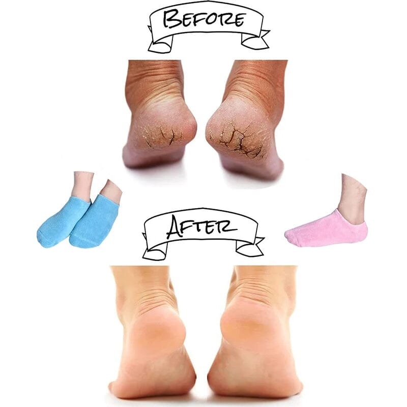 Stornfield moisturizing gel-lined socks