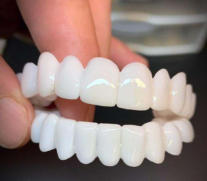 Stornfield | Smile Lens – Adjustable White Denture for Direct Smile Correction