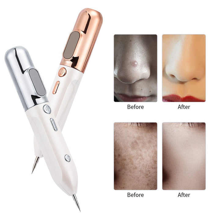Stornfield | HexoPen️ Plasma Pen for Wart and Skin Tag Removal