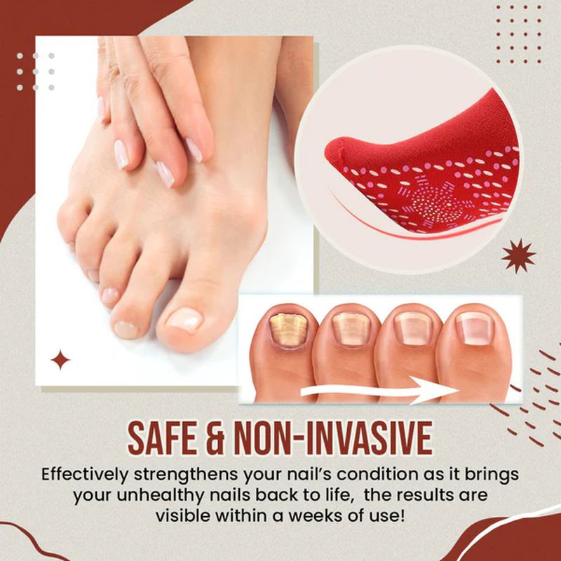 Stornfield | Nail Anti-Fungus Socks