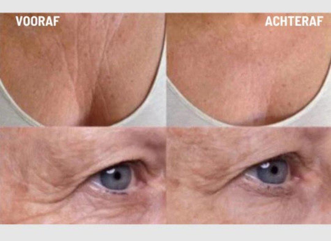 Stornfield | Anti-Wrinkle Silicone Pads