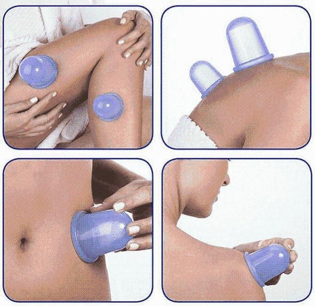 Anti Cellulite Vacuum Silicone Cups | Stornfield