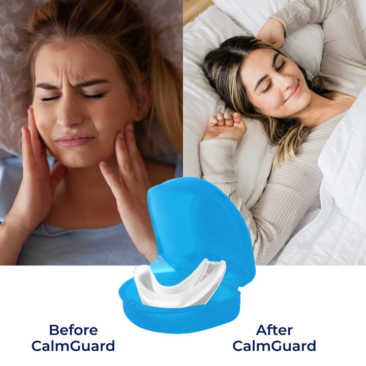 CalmGuard | Night Guard - Bruxism Relief - Custom Fit - For Teeth Grinding and Jaw Clenching Stornfield