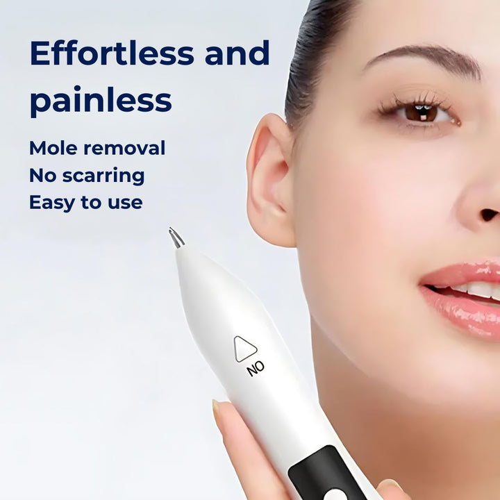 DermaGlow | Mole Removal Pen – Non-Invasive Plasma – Cordless & Rechargeable – At-Home Skin Tag & Freckle Treatment Stornfield