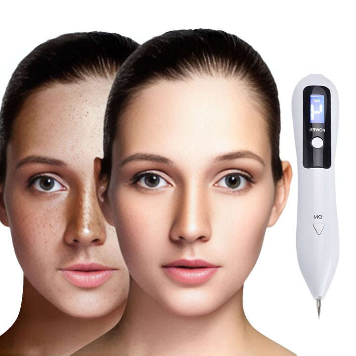 DermaGlow | Mole Removal Pen – Non-Invasive Plasma – Cordless & Rechargeable – At-Home Skin Tag & Freckle Treatment Stornfield