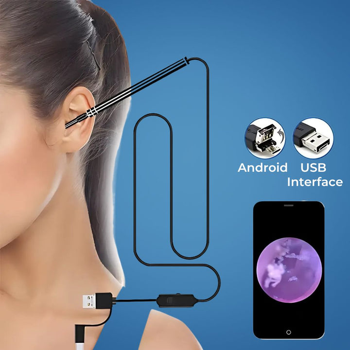 EarVision Professional Ear Endoscope – HD Inspection – Live Monitoring – Capture Images & Video – Removes Wax & Foreign Objects Stornfield