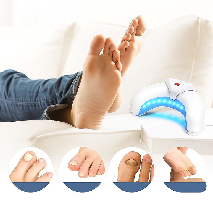 FungiFree | Laser Device for Nail Fungus - Dual Wavelength Penetration - Compact Home Use - Stornfield Fungal Nail Recovery