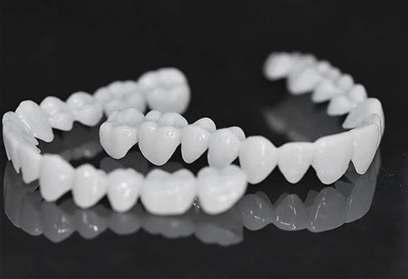 Stornfield | DentAlign Dental Veneers – Natural Fit and Comfort