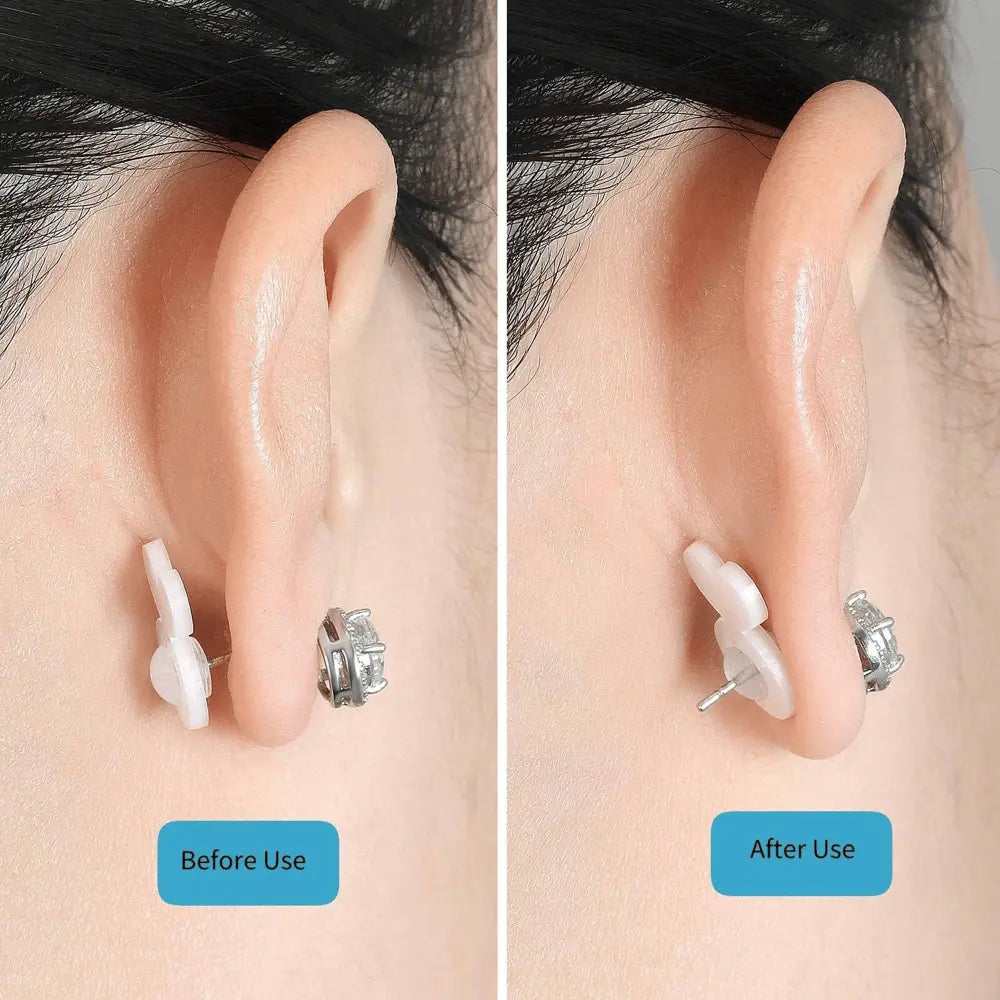 Stornfield | Earring Stabilizer – For secure hold of heavy earrings without sagging