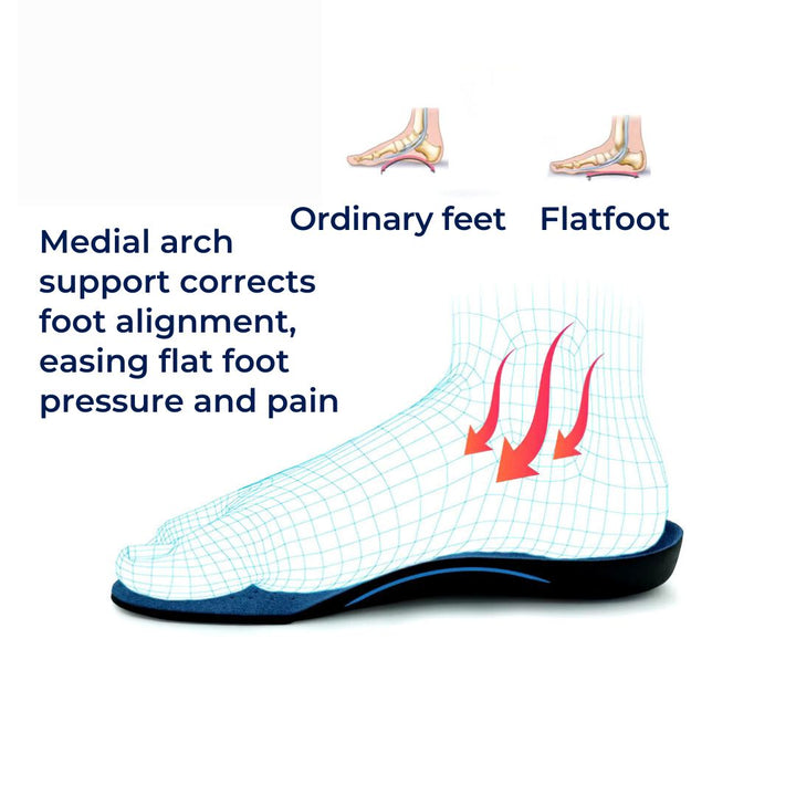 OrthoAlign Pronation Support | Inserts for Foot Alignment and Arch ...