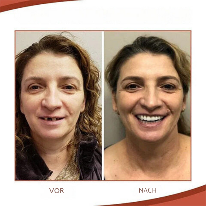 Stornfield | Biocompatible  Prosthesis Set for Pain-Free Fit and Natural Smile