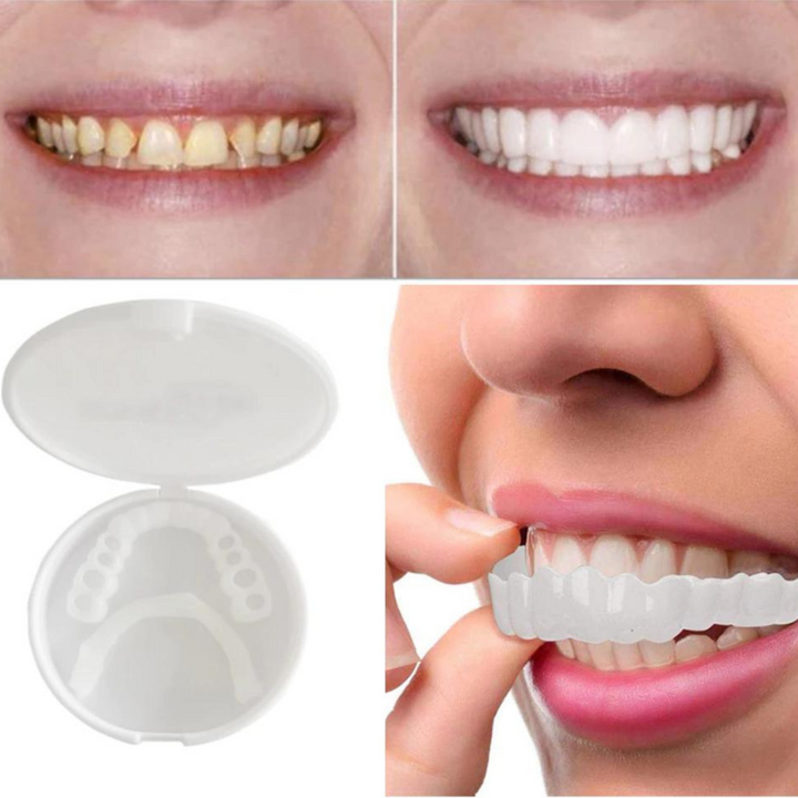 Stornfield | PerfectSnap | Toujours le sourire parfait